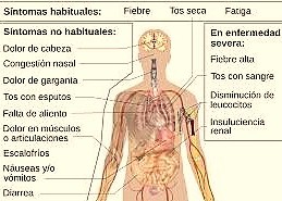 sintoas covid